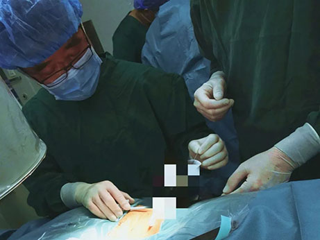 两项国家专利 配合椎间孔镜 让脊柱手术趋于完美