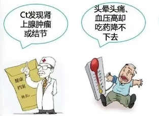 优势学科 | 泌尿外科 “后腹腔镜下右肾上腺肿瘤切除术”为患者精准“拆弹”